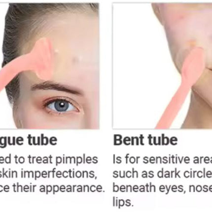 Alta Frecuencia Facial y Corporal